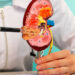 Silent Kidney Disease May Show No Early Symptoms