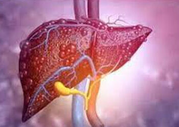 Poor Sleep May Raise Fatty Liver Disease Risk: Experts