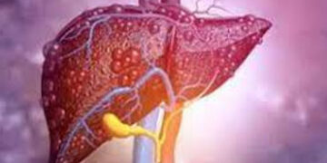Poor Sleep May Raise Fatty Liver Disease Risk: Experts