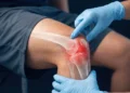 Early Arthritis Screening in the Netherlands Shows Lasting Benefits