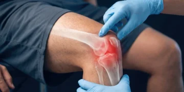 Early Arthritis Screening in the Netherlands Shows Lasting Benefits