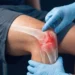 Early Arthritis Screening in the Netherlands Shows Lasting Benefits