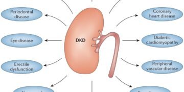 Diabetes linked to changes in kidney function and electrolyte levels study finds