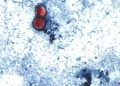 Declining FDA inspections raise concerns after cyclospora outbreak
