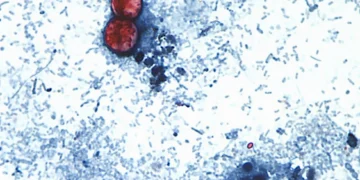 Declining FDA inspections raise concerns after cyclospora outbreak