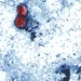 Declining FDA inspections raise concerns after cyclospora outbreak