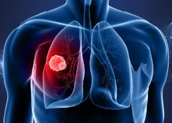 Why non-smokers are getting lung cancer