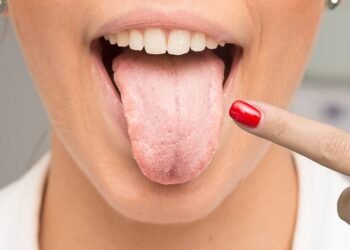 Psoriasis treatments show different infection risks study finds