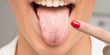 Psoriasis treatments show different infection risks study finds