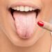Psoriasis treatments show different infection risks study finds