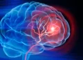Ozempic may be linked to Lower Stroke and Alzheimer’s risk study finds