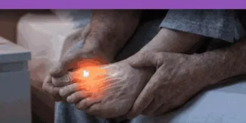 Global Gout cases set to reach 95.8 million by 2050 men face higher risk