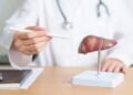 AI Model predicts Diabetes risk in patients with fatty liver disease