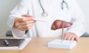 AI Model predicts Diabetes risk in patients with fatty liver disease