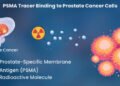 PSMA-PET guided Brachytherapy shows promise in recurrent Prostate Cancer