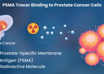 PSMA-PET guided Brachytherapy shows promise in recurrent Prostate Cancer