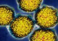 Study finds combined respiratory virus spread best predicts hospital admissions